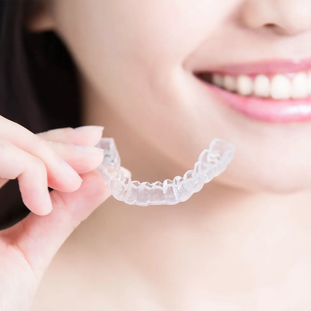 Smartee GS 認定ドクターが担当します 南青山デンタルクリニック広島医院