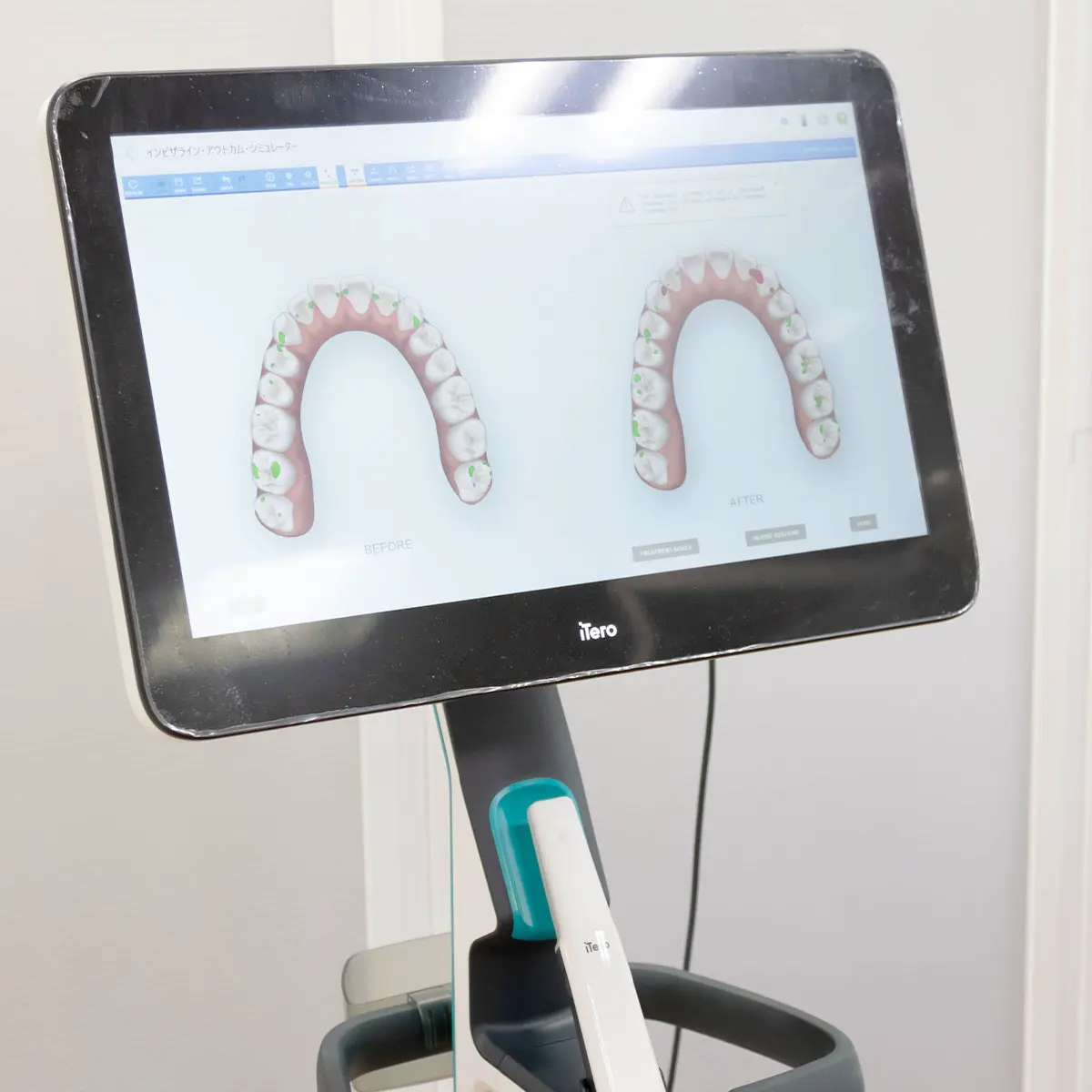 iTero Lumina 導入 南青山デンタルクリニック広島医院