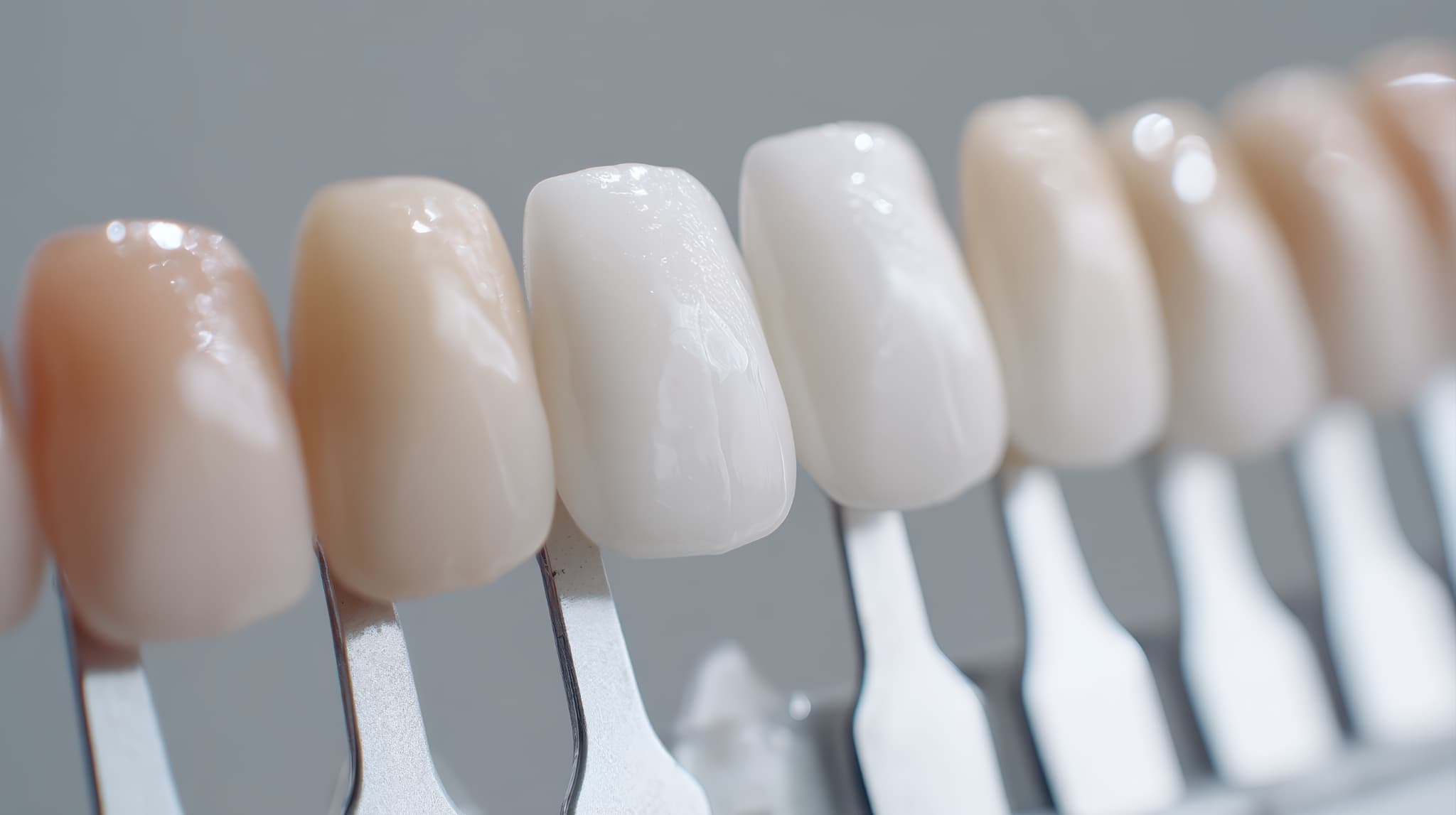 審美歯科の治療の様子