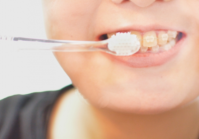 小児矯正の基本:1期治療・2期治療とは?