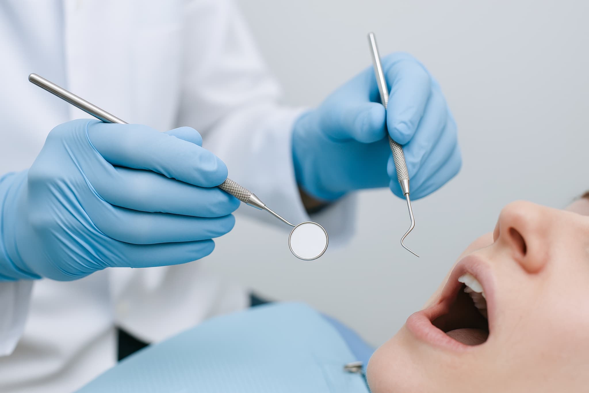 重度の虫歯を予防するため定期検診を受診する女性