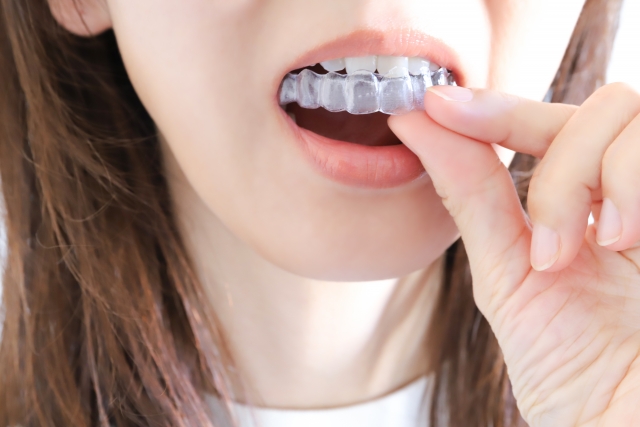 「今の生活」はそのままで。マウスピース矯正が選ばれる理由
