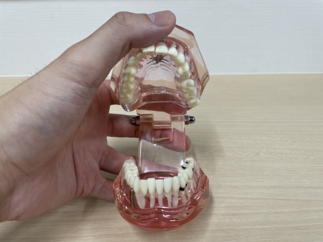 納得して治療を始めるための、精密な診査・診断の重要性